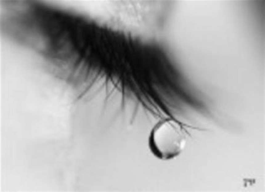2.热泪:眼睛红肿疼痛,怕见光,眼泪黏浊,多与其他眼病并发. 查看全部