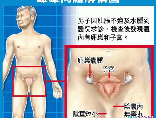 阴阳人雌雄同体器官和结构图